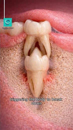 How baby teeth turn in to permanent teeth?