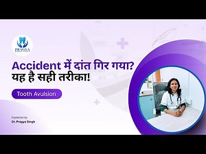 Tooth Avulsion Explained: Save Your Tooth in 30 Minutes!