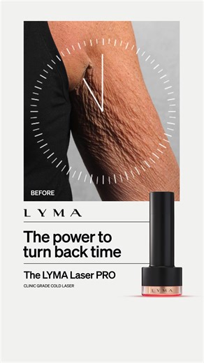 1.2K views | Want results like this in just 30 days? Meet the device that treats what others can't. The LYMA Laser PRO gives you the power to change your skin age - at home, on your terms. ✔️ Skin is drastically transformed: wrinkles are radically improved, elasticity is restored, sagging is reversed, and pigmentation is faded ✔️ Revolutionary clinical-grade cold laser technology, engineered to make skin look younger by triggering a genetic switch inside each cell | LYMA | Facebook