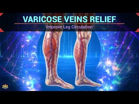 VARICOSE VEINS RELIEF | Improve Leg Circulation | Soothe Tired, Heavy Legs | Healing Music