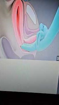 PV and Bimanual Examination