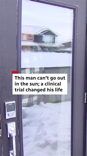 Kris Kinar lived with Erythropoietic protoporphyria (EPP), a rare sun-sensitivity disorder causing immediate severe pain upon sun exposure, for decades undiagnosed in sunny Saskatoon. Forced to remain indoors, he sought rare disease organizations, leading him to a clinical trial at Massachusetts General Brigham. There, he met Dr. Amy Yeung, an attending physician at Massachusetts General Hospital and Harvard Medical School assistant professor who also has EPP. The trial drug, Bitopertin, decreas