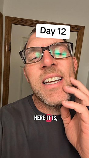 Day 12 of Growing a Beard. I almost forgot this update, but here it is. How do you think the beard is coming along? | Shaver Dude