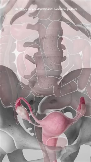 Hysterectomy Procedure 3D Animation #hysterectomy #hysterectomysurgery #hysteroscopy #hysteroscopysurgery #hysteroscope