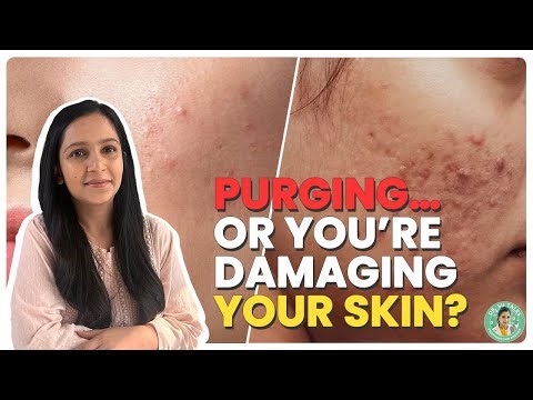Purging vs Breakouts | Dermatologist Explains! 