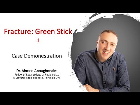 | MSK | Trauma | Greenstick fracture |