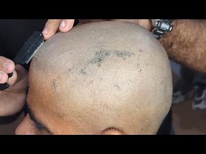 Hard attractive too much dandruff clean head shave ASMR relaxing sound tutorial zaibi barber shop