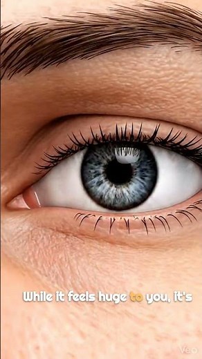 Why Your Eye Won’t Stop Twitching! 👁️🛑 (Eyelid Myokymia)