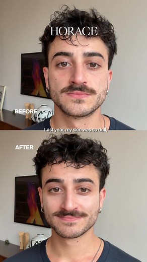 No more dullness. No more redness. Just calm, glowing skin with Horace. | Horace