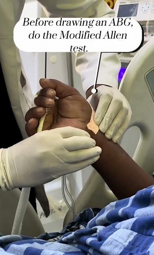 ABG Procedure for Beginners | Clinical Skill Demonstration #ABGProcedure #arterial blood gas