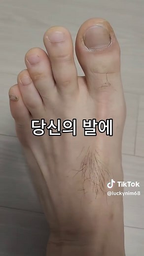 췌장암 초기 신호 확인하기: 건강 정보 및 팁