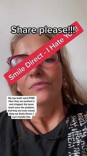 SMILE DIRECT I HATE YOU #smiledirectclub #teethtok #teethtransformation #teethhealth #reallifeworks