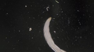 Fast Moving Nematode Trematode Worm Under Stock Footage Video (100% Royalty-free) 1097549691 | Shutterstock