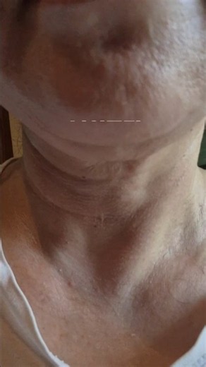 목주름에 이걸 발라봤더니? 👀