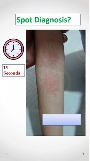 Dermatology Spot Diagnosis Quiz #1