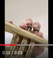 Trigger finger in musicians — Musicians' Hand Clinic