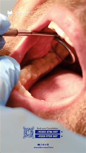 Pain spreading to your jaw, ear, or head? It could be your tooth.