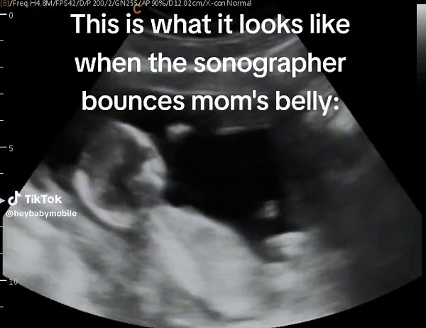Ever wonder what it looks like in there, when you poke your belly, run up the stairs, or when you start laughing? #heybabymobile #14weeks2dayspregnant #momlaughing #pokethebelly #bouncingbaby #electiveultrasound #2dultrasound #pregnancy #pregnancyultrasound #rochesternyultrasound www.HeyBabyMobile.com