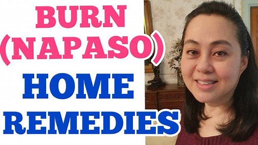 331K views · 8.5K reactions | Burn (Napaso) : Home Remedies and Treatment Tips by Doc Liza Ong 1. Ang napasong parte ng balat ay itapat sa tubig ng 15-20 minuto. 2. Huwag yelo ang ilalagay na derecho sa balat. Watch the video: | Doc Willie Ong | Facebook