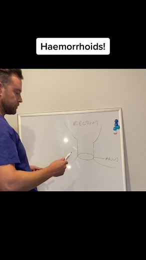 Understanding Hemorrhoids: Symptoms and Treatments