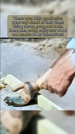 They Built Real Cyborg Arms In 1921