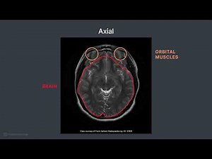 Patient Positioning and Protocol for a Routine Brain MRI