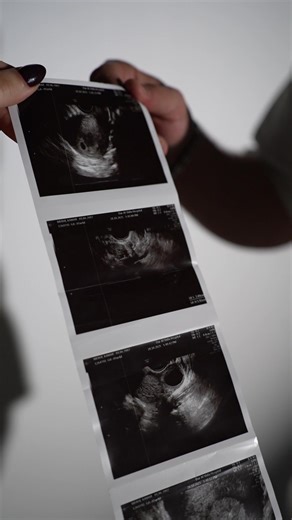 فيديو عشت معهم فيه كل لحظة مشاعر 🥹🤍 فرحة تُلامس القلب 🌸 اللهم احفظ جنينها بعينك التي لا تنام، وتمّم حملها بسلام #جنس_الجنين #genderreveal #pregnant #حامل #kuwait