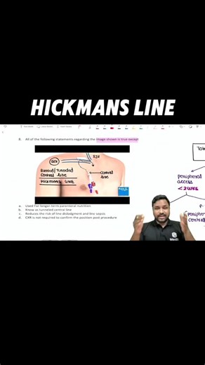 Surgery King on Instagram: "HICKMANS LINE. . . . #mbbs #medicaleducation #neetpg #inicet #fmge #pwmeded #pw #mbbssubjects #physicswallah @the_surgery_guy"
