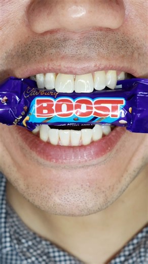 Satisfying ASMR | Boost Chocolate #satisfying #asmr #boost #chocolatelovers | Doctor Tristan Peh