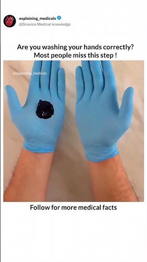 🧼 Are You Washing Your Hands Correctly? The Step Most People Miss!