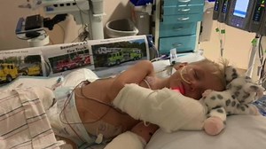 3-year-old's legs amputated after developing MRSA staph infection on family vacation