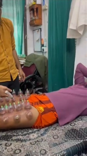 Dr Sachin chhonker | Cupping therapy offers benefits like pain relief, improved circulation, and muscle relaxation, and may help with respiratory and digestive... | Instagram
