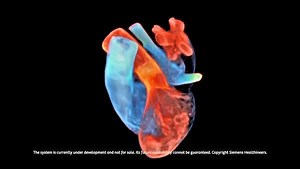 2.6K views · 130 reactions | Learn how a digital twin heart model...