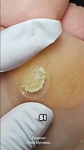 Would you like to learn aesthetic pedicures, foot spa treatments, and ingrown toenail techniques? 👣