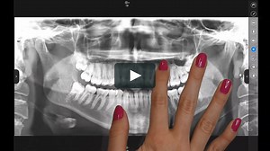 Planmeca mRomexis mobile imaging application