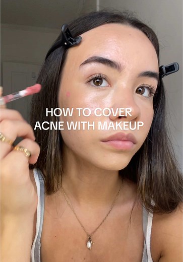 Replying to @AUDREYYY How i cover my acne with makeup #acne #coveracne #makeup #trending #coveracnemakeup