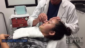 Septoplasty Results After Six Weeks