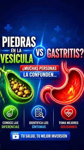 ¿Gastritis… o PIEDRAS en la vesícula? ⚠️ La mayoría lo confunde