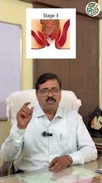 Can Piles Be Cured with Medicines? Stage-Wise Treatment Explained | Do You Really Need Surgery?