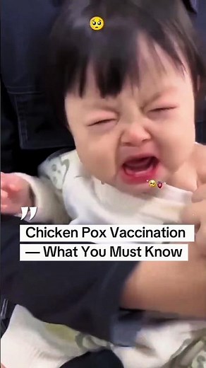 Why Every Child (and Adult) Needs the Chicken Pox Vaccine