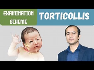 Torticollis Examination | Complete Step-by-Step Clinical Guide