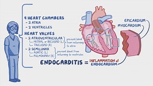 Video: Endocarditis: Nursing - Video Explanation! | Osmosis | Osmosis