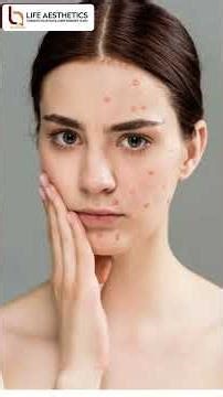 How Smoking & Alcohol Harm Hair, Skin & Personality | Dr. Ashwini Dash