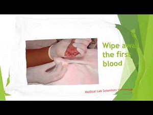 DBS Samples collection techniques