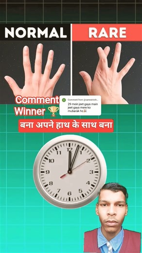 Who is so rare? #facts #quiz #cartoon #gk #braintest #riddles #riddlejourney #puzzle #shorts #puzzle