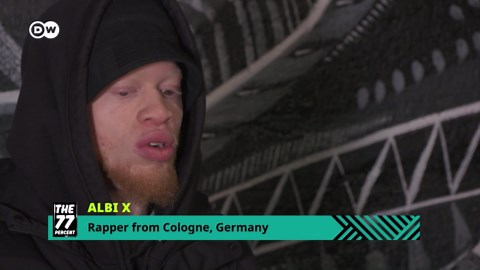 Meet Albi X: Uplifting lives through music