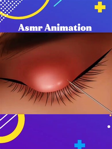 Eye Cleaning and Treatment ASMR Animation