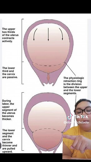 Understanding Uterine Contractions During Labor