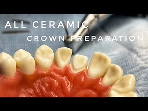 Anterior Crown Preparation