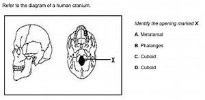 Refer to the diagram of a human cranium.Identify the opening ... | Filo